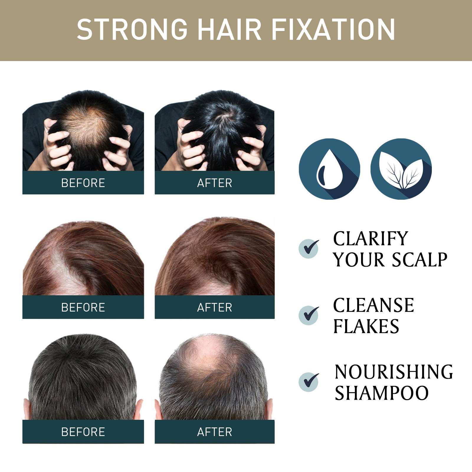2pcsx100ml Hair Growth Shampoo - Hair Care Natural Ingredients ulasan dan harga